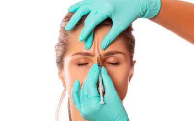 Botox: The Ultimate Guide